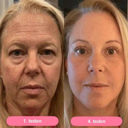 Serum Collagen