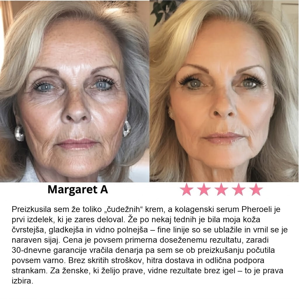 Serum Collagen