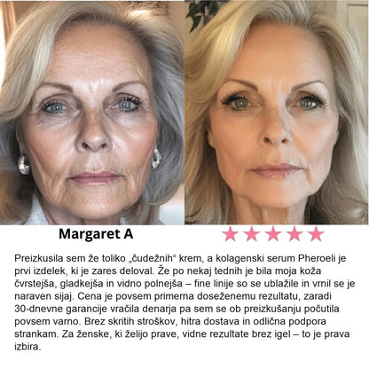 Serum Collagen